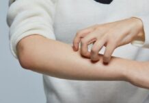 여름철 더 예민해지는 아토피피부 관리